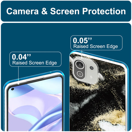 Edel designte Luxus Marmor Handyhülle für Xiaomi Mi 11 Lite 4G/5G