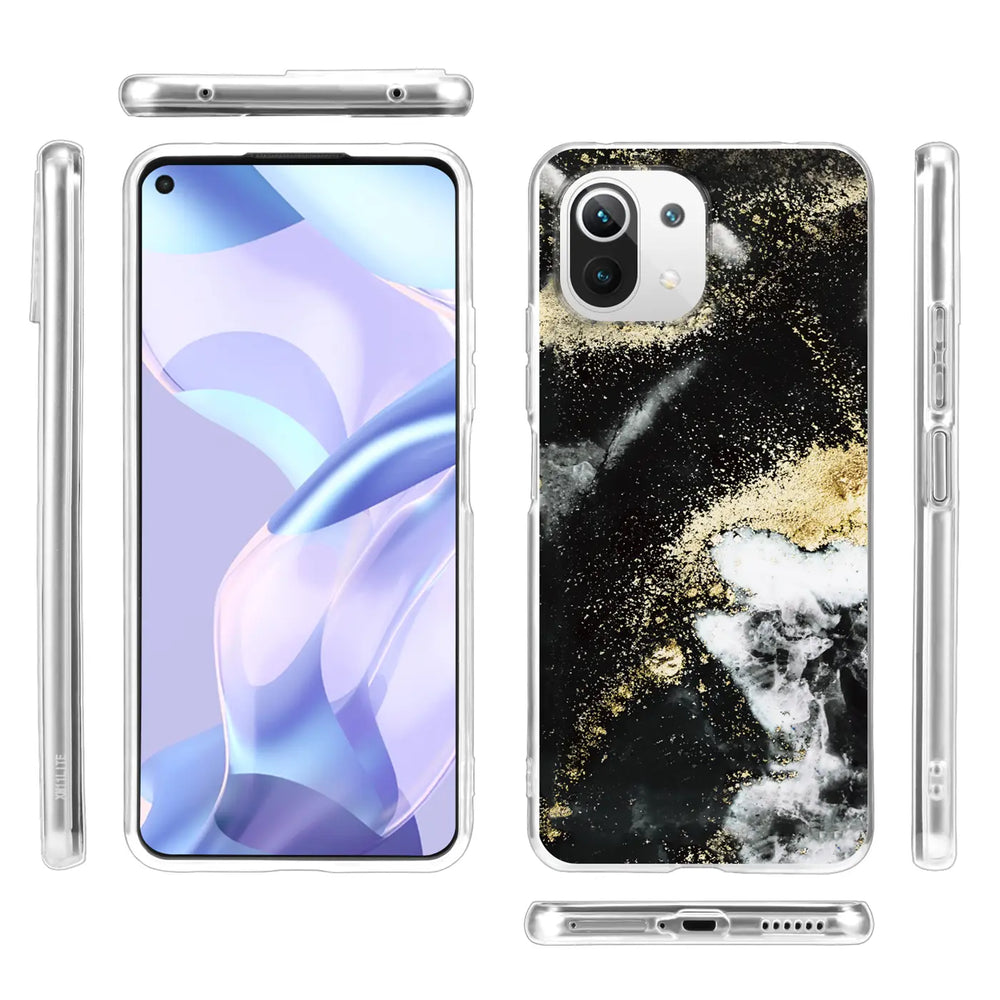 Edel designte Luxus Marmor Handyhülle für Xiaomi Mi 11 Lite 4G/5G