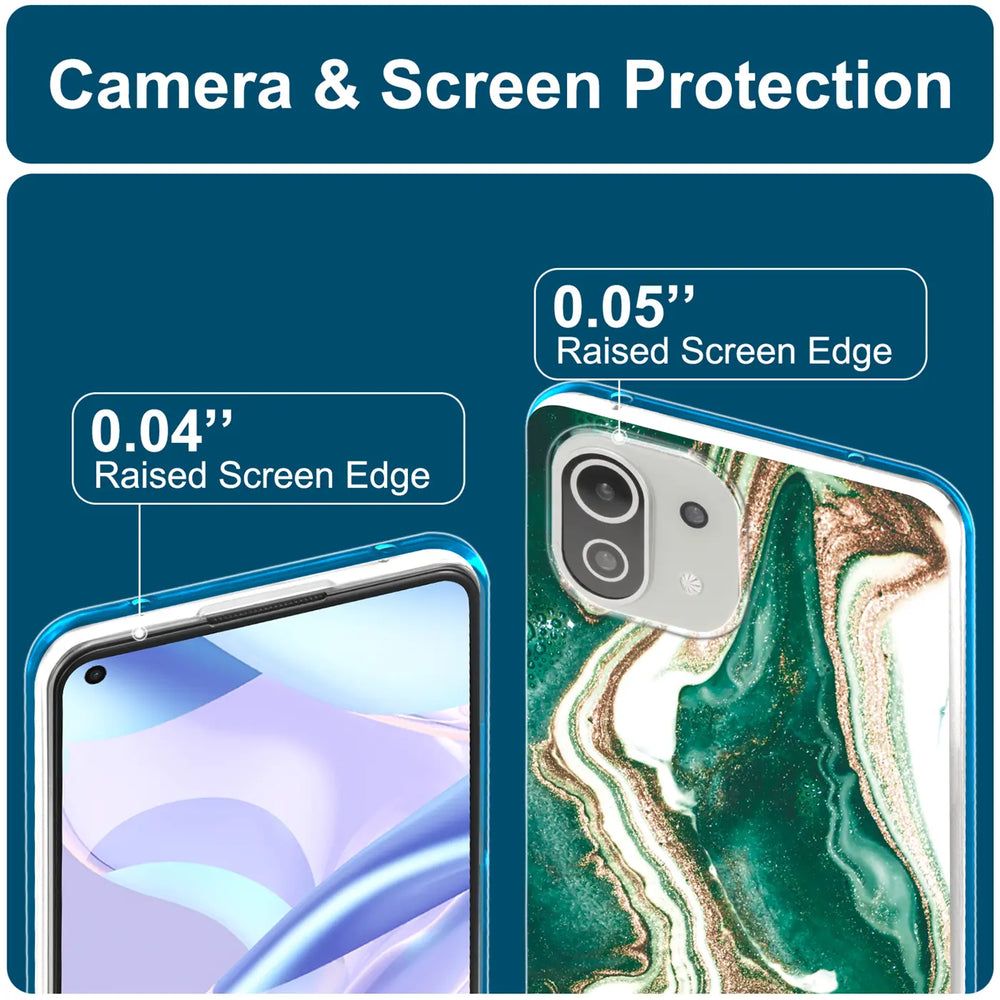 Edel designte Luxus Marmor Handyhülle für Xiaomi Mi 11 Lite 4G/5G