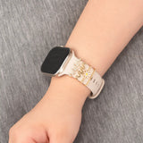 Elegante Charms & Deko-Ringe für Smartwatch Smartwatch – Armbandschmuck-Set für 20–22 mm Silikon- und Sportarmbänder, stilvoll & funkelnd